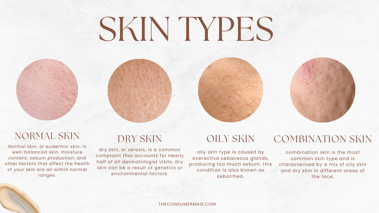 skin types 